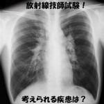 サルコイドーシスのレントゲン
