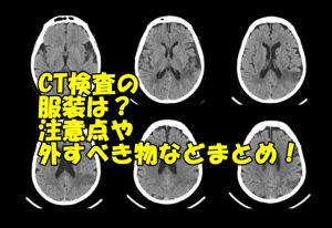 ct検査の服装と注意点